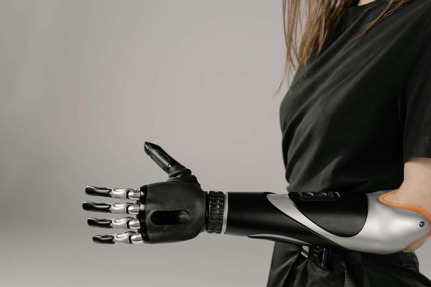 Female with a prosthetic arm